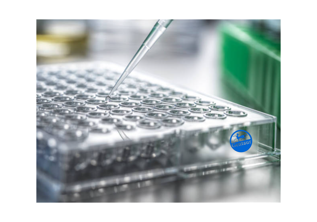 ELISA  Acetyl-HIST1H1C (K89) anti-