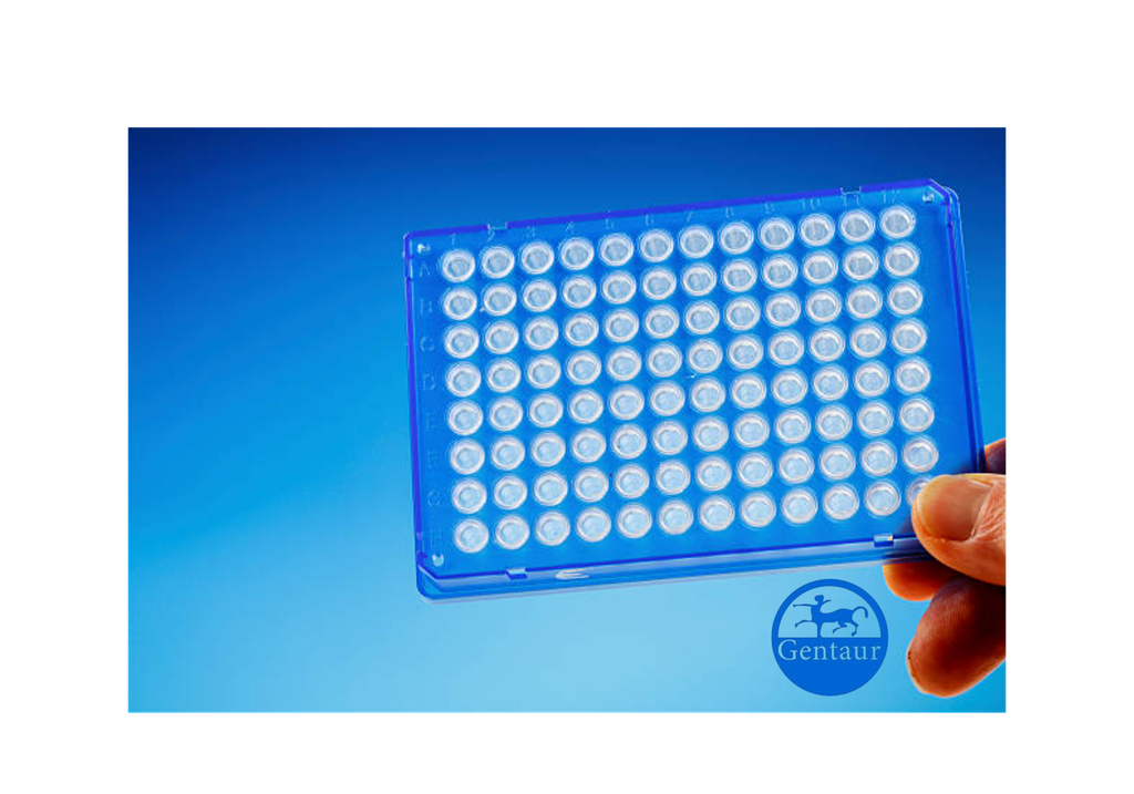 ELISA  Acetyl-TP53 (K372) anti-